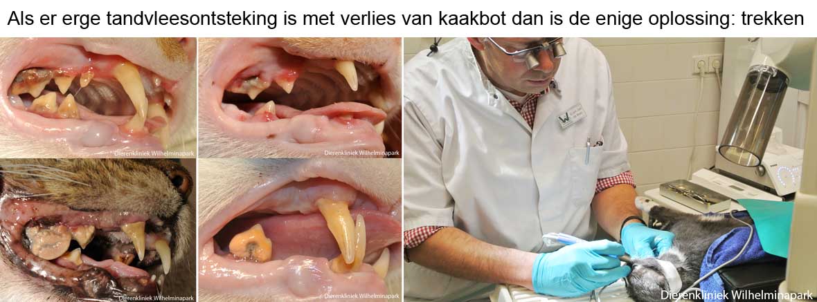 maand van het gebit: voorkomen door poetsen is beter dan extractie van de kiezen